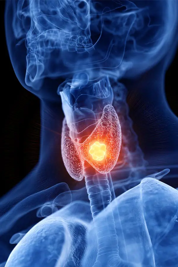 Thyroid-Imbalance-Treatment A 3D illustration of an x-ray of a human neck, highlighting the thyroid. Get help with thyroid imbalance from Better Life Carolinas of Charlotte in Charlotte Metro.